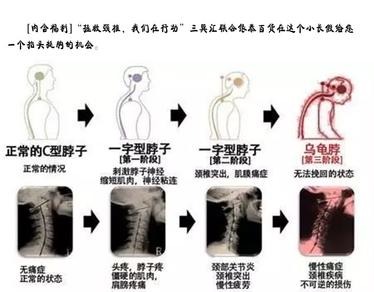 道家养生——肩颈保养 道家养生——肩颈保养
